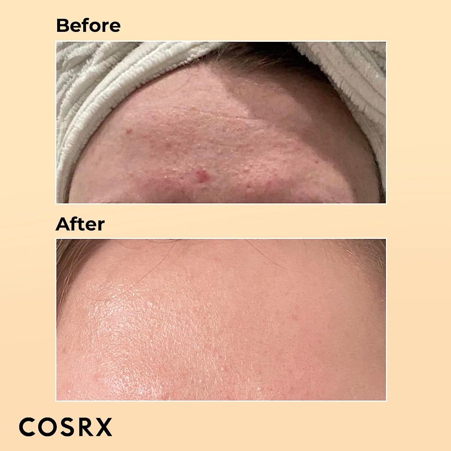 COSRX Snail Mucin Moisturizer